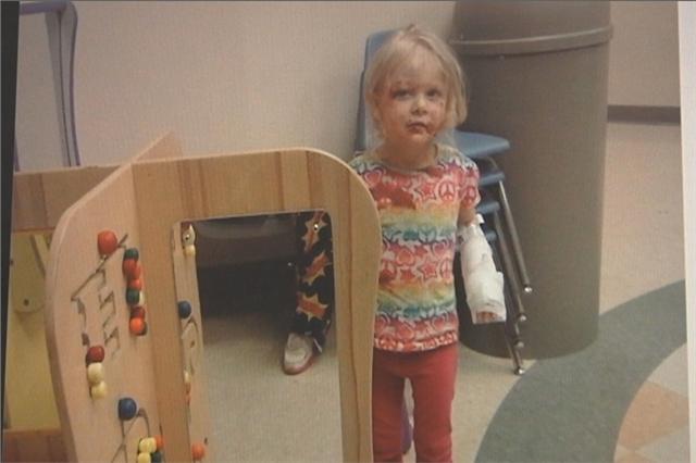 Two-Year-Old Recovering After Dog Attack